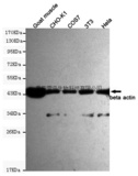 Anti-β-Actin Mouse mAb